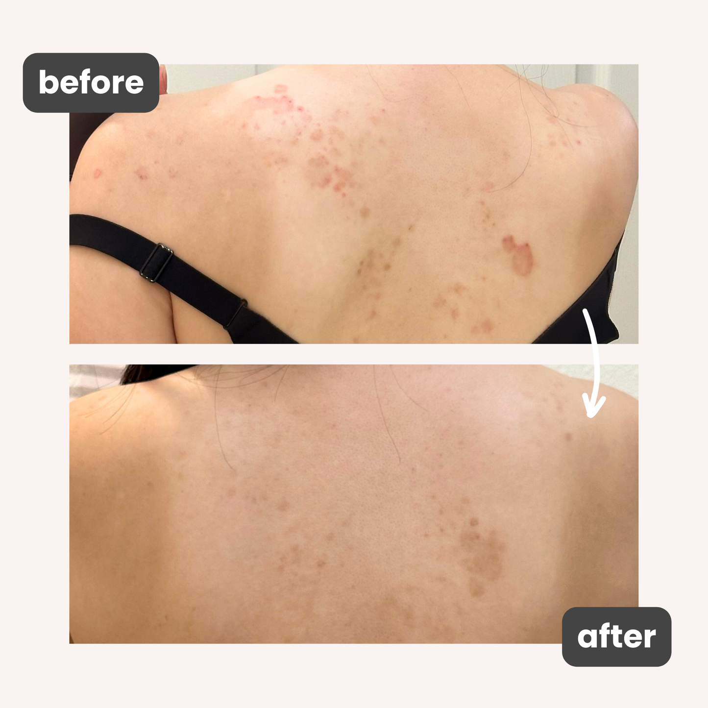 Healing Balm